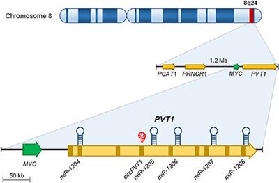 Long Non-coding RNA PVT1 as a Prognostic and Therapeutic Target in Pediatric Cancer